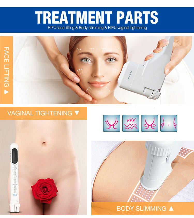 Professional Korea Vagina Hifu Ultrasound Hifu Vaginal Tightening Machine