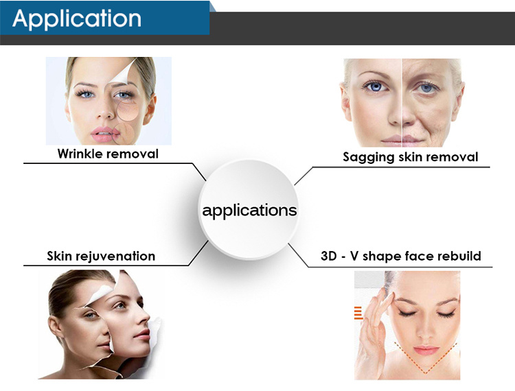 ADSS Face Lifting and Skin Tightening Beauty Machine--Hifu