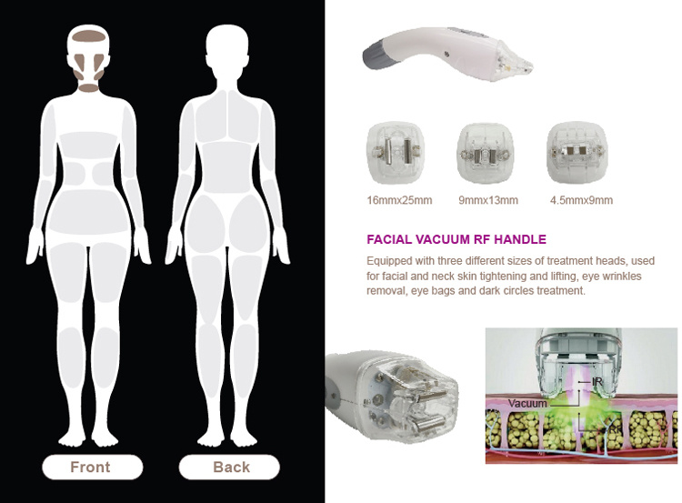 Cheap Beauty Salon Equipment Physiotherapy Equipment Cellulite Massager Roller Massage Vacuum Cellulite Machine