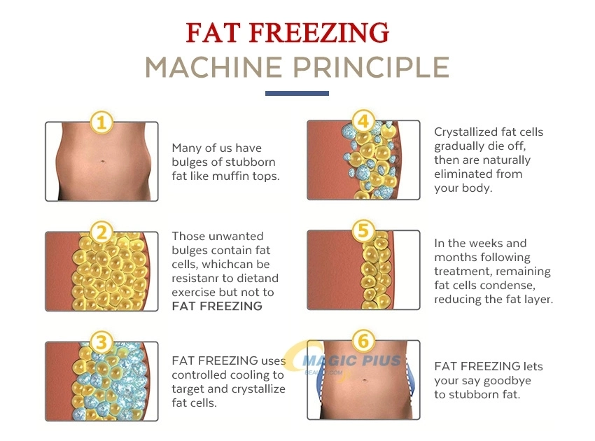Four Handles Zeltiq Cryolipolysis Fat Freezing Machine Cryolipolysis Slimming Cool Body Sculpting Machine for Fat Reduction