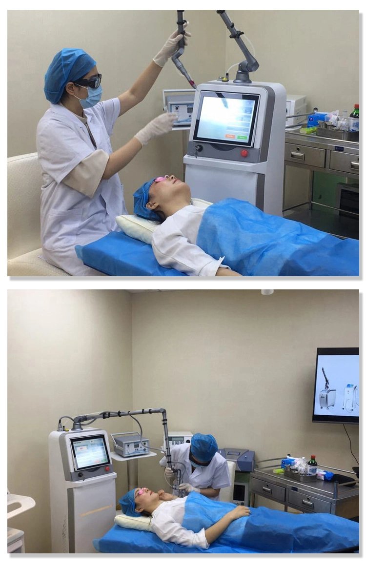 Hot Sales Fractional CO2 Laser Machine for Skin Treatment Face Resurfacing Equipment