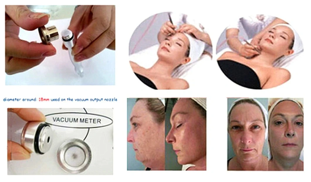 Hot Microdermabrasion Diamond Peeling Beauty Machine for Skin Peeling