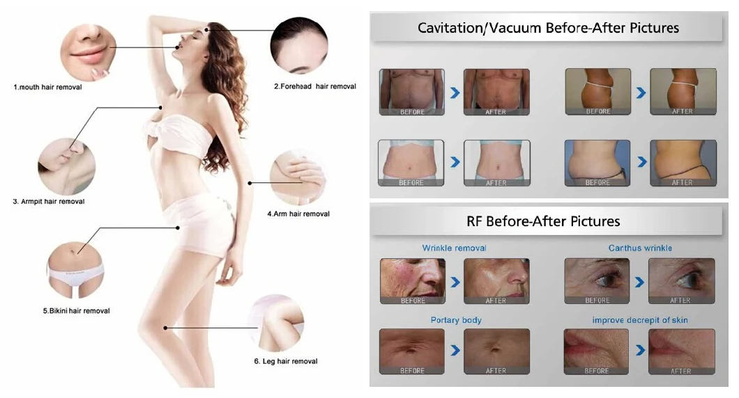 Favorable Price Body Slimming Ultrasound Cavitation Machine Body Sculpting Vacuum RF Shaping Ultrasonic Vibration Fat Removal