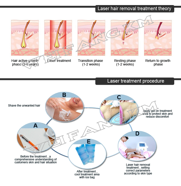Painless Portable 808nm Diode Laser Hair Removal Machine / Laser Hair Removal Machine Factory Price