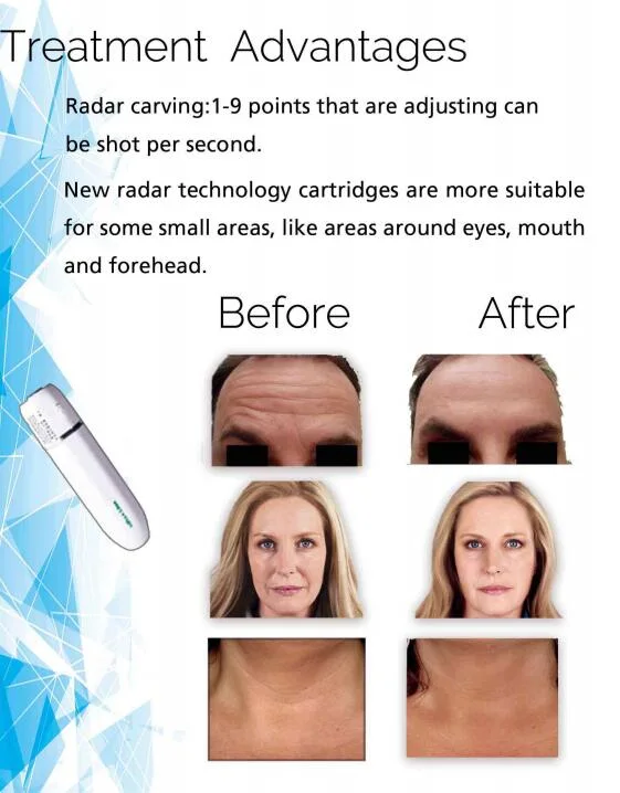 2020 Trendy 5D 4D Hifu Ultrasound Devices Face Lifting Anti Wrinkle Portable Machine Hifu Device