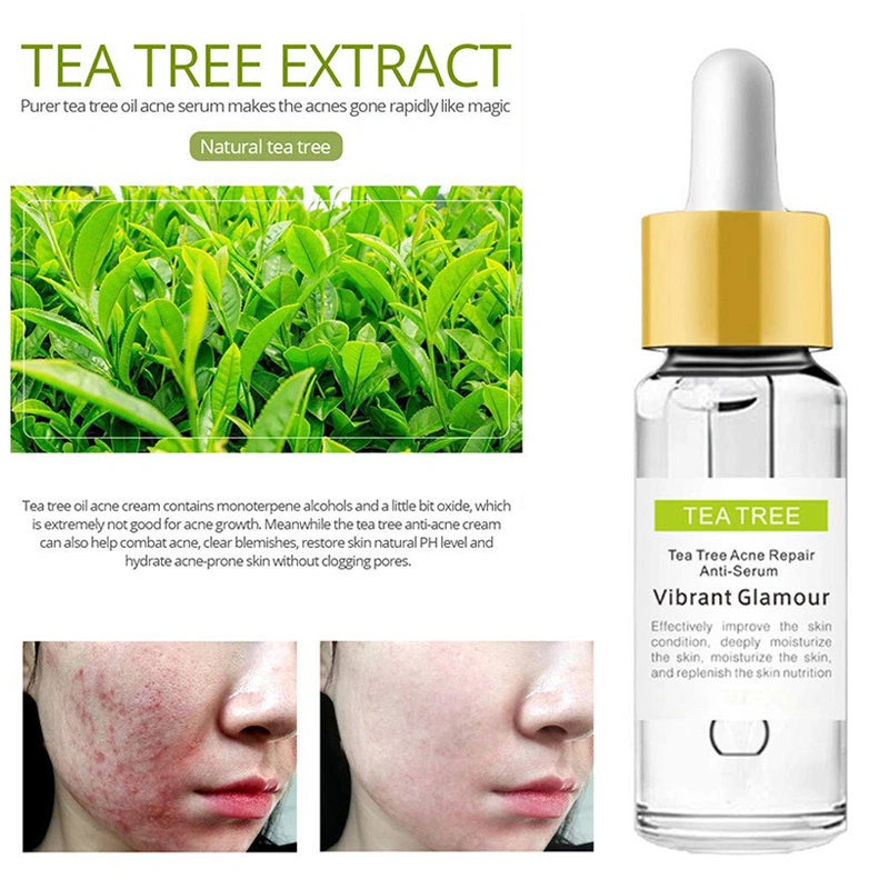 Private Label Acne Removal Pimple Repair Skin Care Tea Tree Acne Treatment Serum