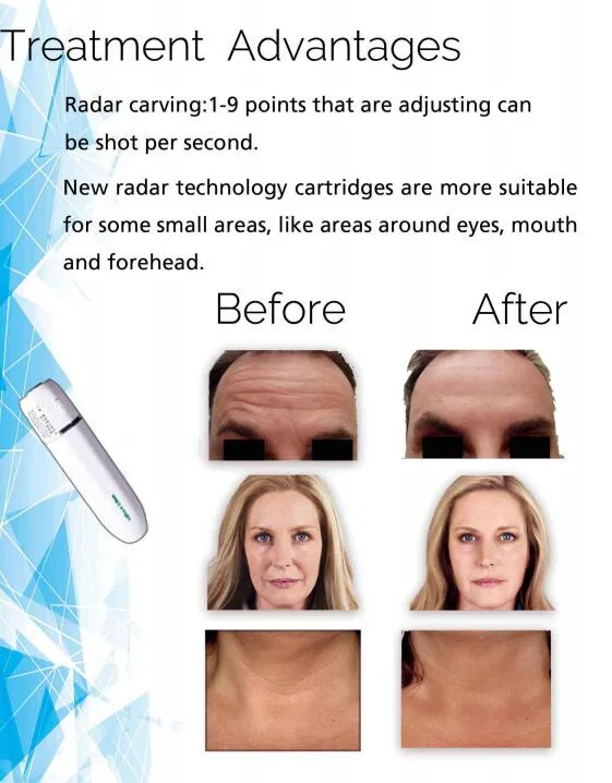 Sincoheren 4D 5D 3D Hifu Machine Hifu Facial and Body for Skin Lifting and Fat Loss