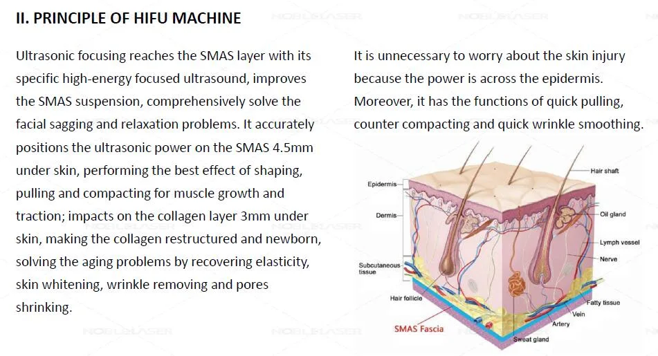 2019 Advanced 3D Hifu Face and Body Lifting Machine 20000/Smas Hifu Ce Certificate Noble Laser