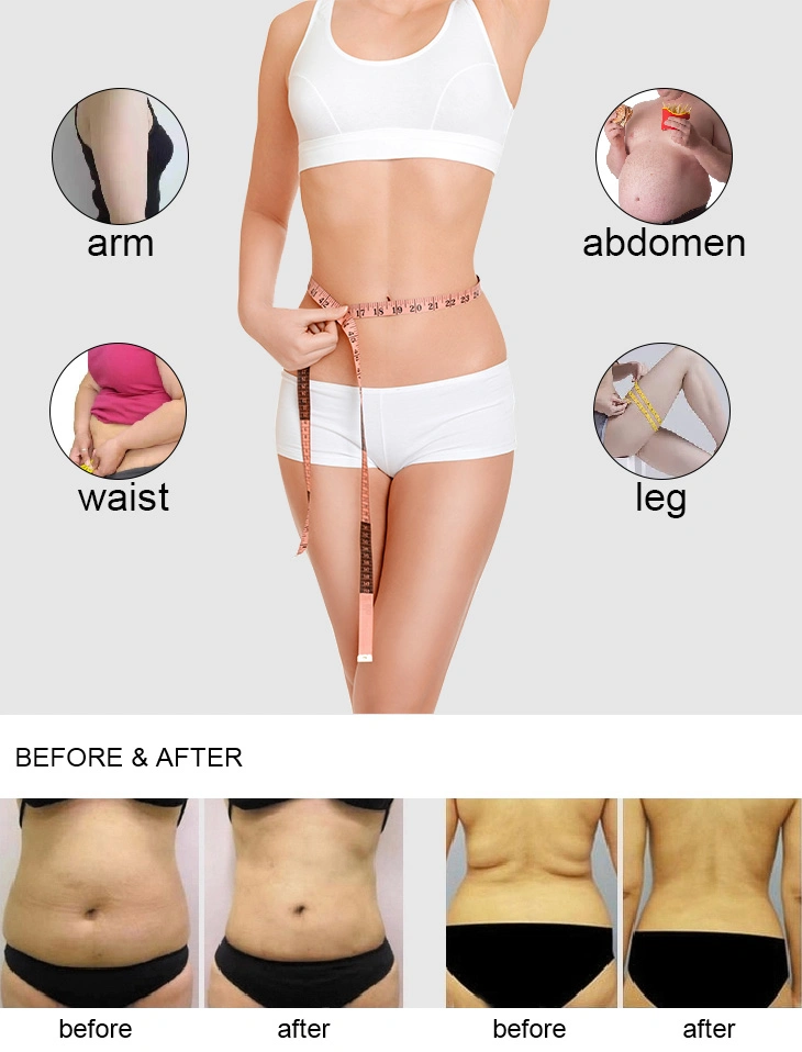 2020 Hifu Liposonix Body Slimming Skin Tighten Face Lifting Beauty Equipment