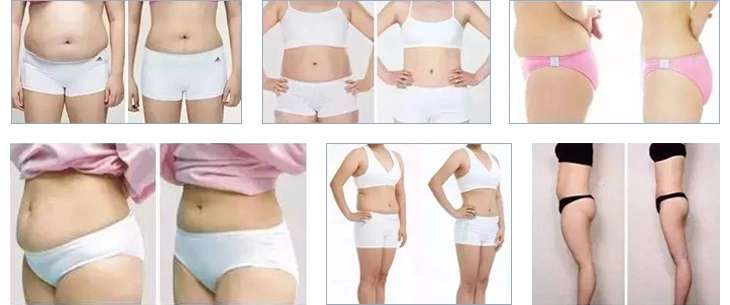 Portable Liposonix Focused Hifu Body Slimming Body Shape Weight Loss Slimming Machine