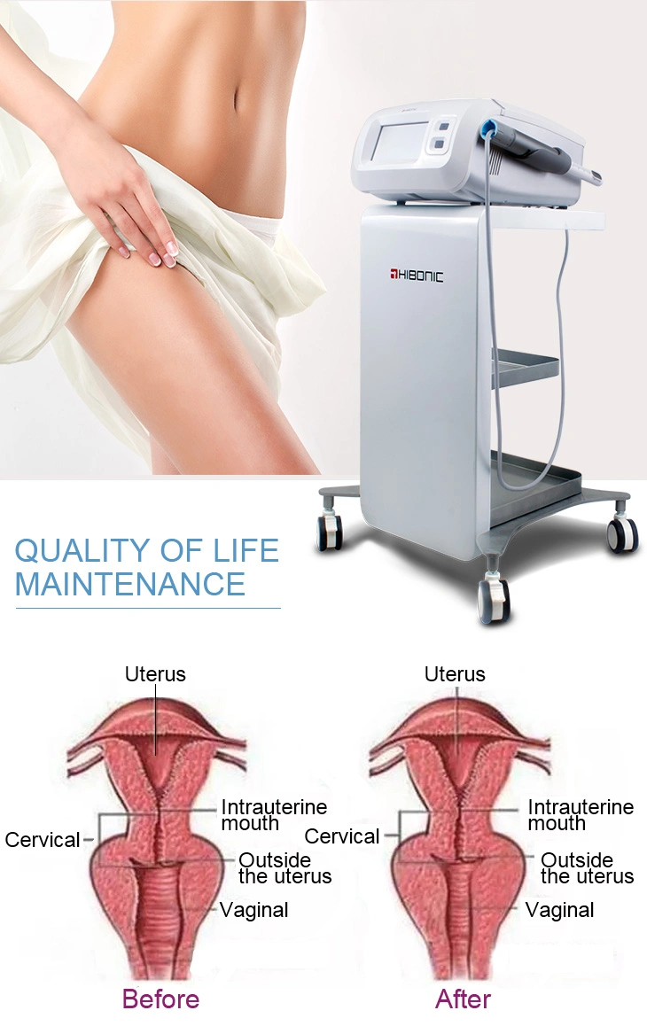 Painless Female Private Care Hifu Vaginal Tightening and Vaginal Rejuvenation for Skin Care Beauty Equipment