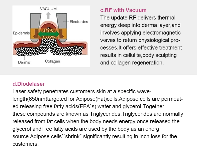 Easy to Use RF Cavitation Fat Loss Machine for Weight Loss Body Sculpting Machine