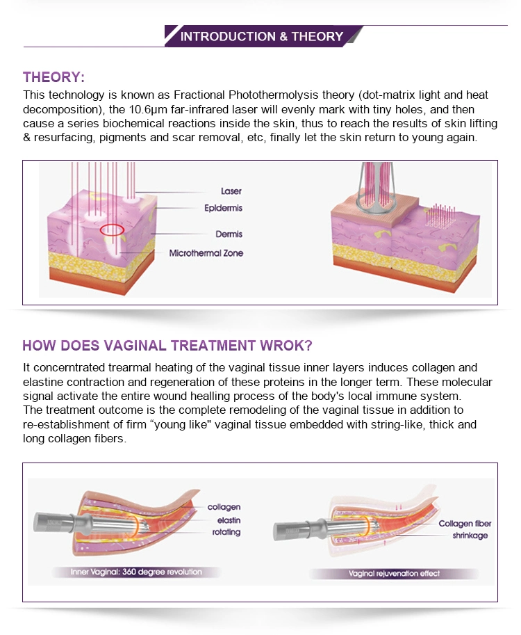 Fractional CO2 Laser Vaginal Tightening Machine/Laser Pigment Removal/Laser Skin Resurfacing Anti Aging Wrinle Removal