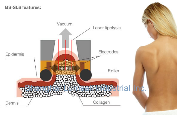 Burning Fat Cell Body Shape Machine Skin Tightening Anti Cellulite Lipo Roller Body Cellulite Massage