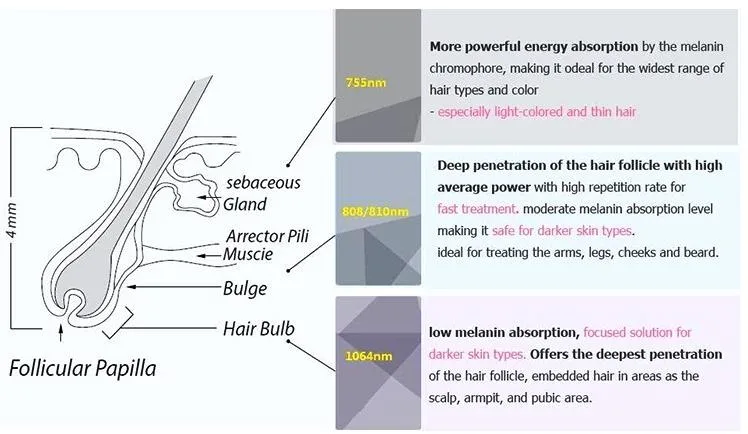 808nm Laser Diode Price/Alexandrite Diode Laser Hair Removal/808nm Diode Laser Hair Removal Machine