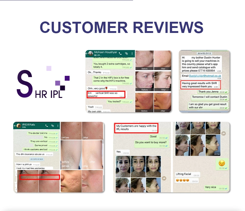 IPL Hair Removal Laser Device Prices Diode Laser Permanent IPL Hair Removal Device for Man