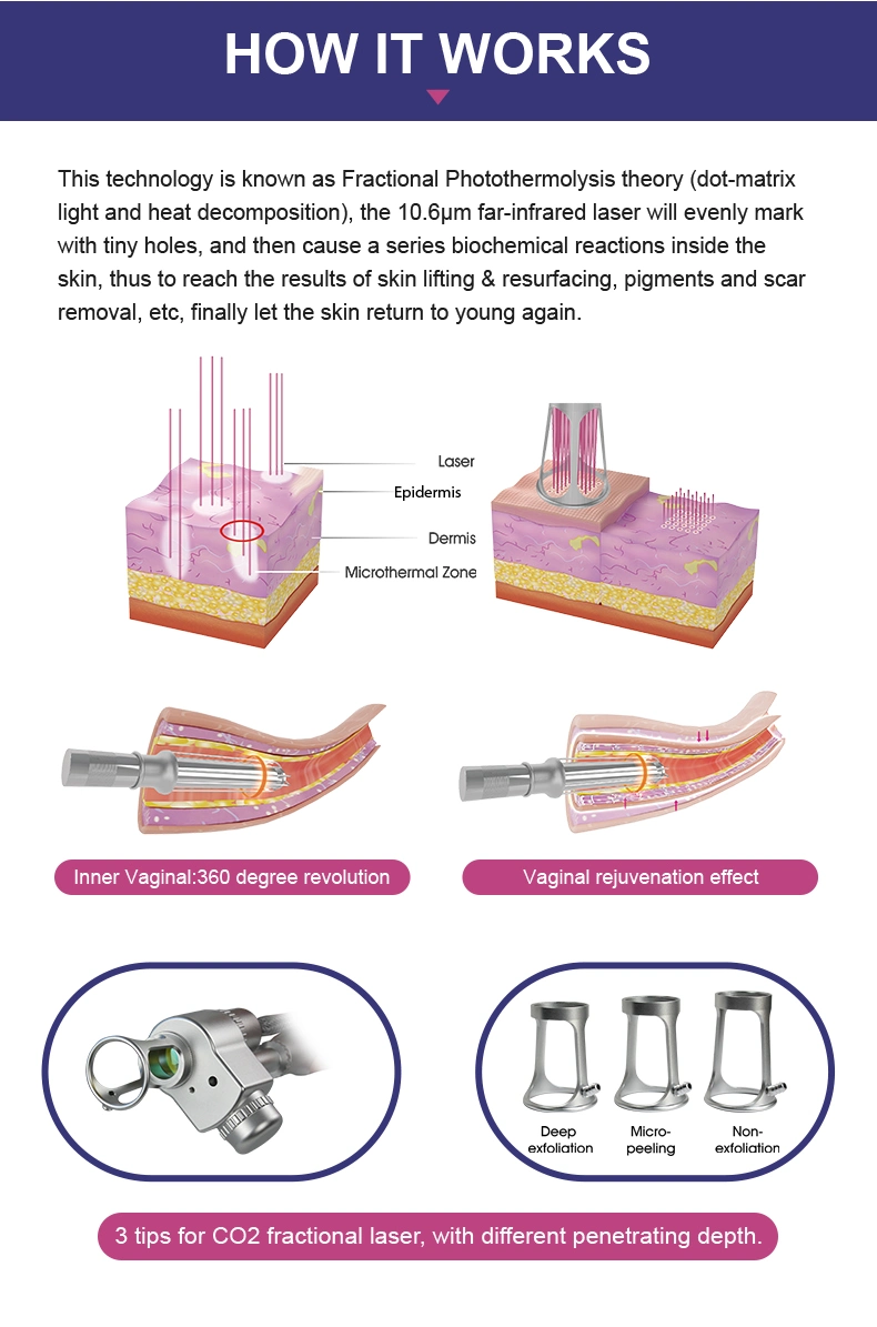 Super Quality Fractional CO2 Laser Machine Fractional CO2 Laser Equipment