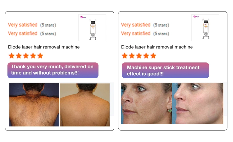 IPL Laser Hair Removal Machine Multifunction Painless Pigment Removal IPL for Black Skin