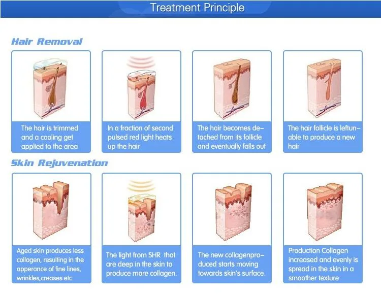 Dpl Shr IPL Hair Removal Laser for Beauty Machine