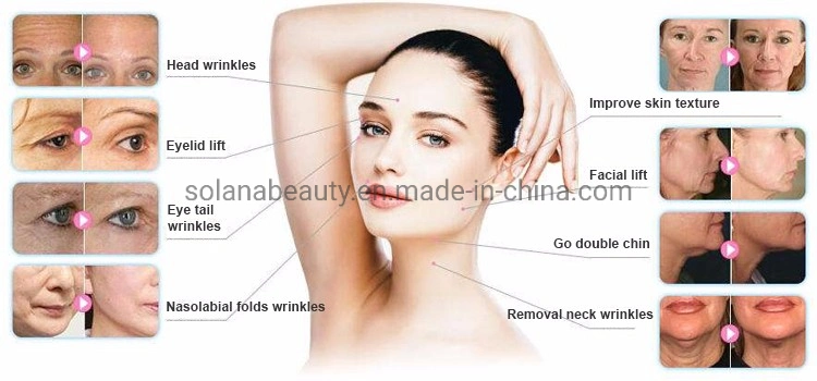 Ultrasound Hifu Vmax Hifu Anti-Wrinkle Anti-Aging Machine