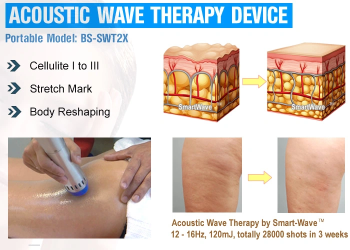 Shockwave Device Anti Cellulite Treatment Machine Shockwave Therapy Cellulite and Body Reshaping Beauty Machine