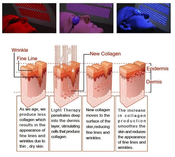 High Power Bio LED Light Photodynamic Therapy Beauty Device (Huafeilaser)