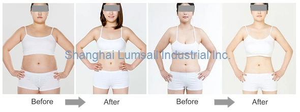 Body Shaping Fat Freezing Fat Body Slimming Machine Freezing Product