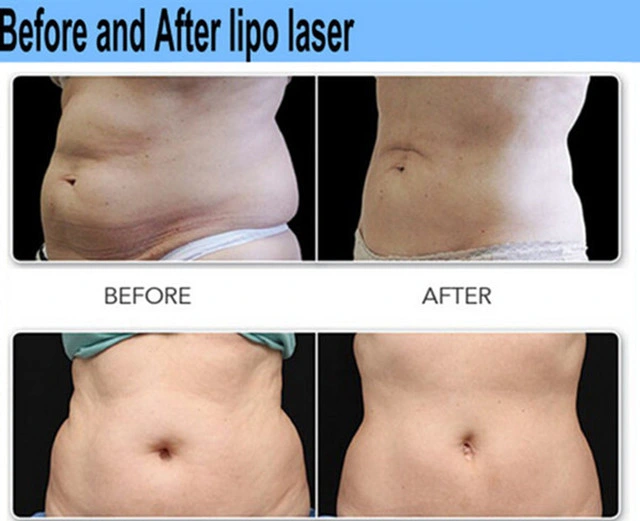 Professional Body Shaper Diode Lipo Laser Body Slimming Machine for Weight Loss