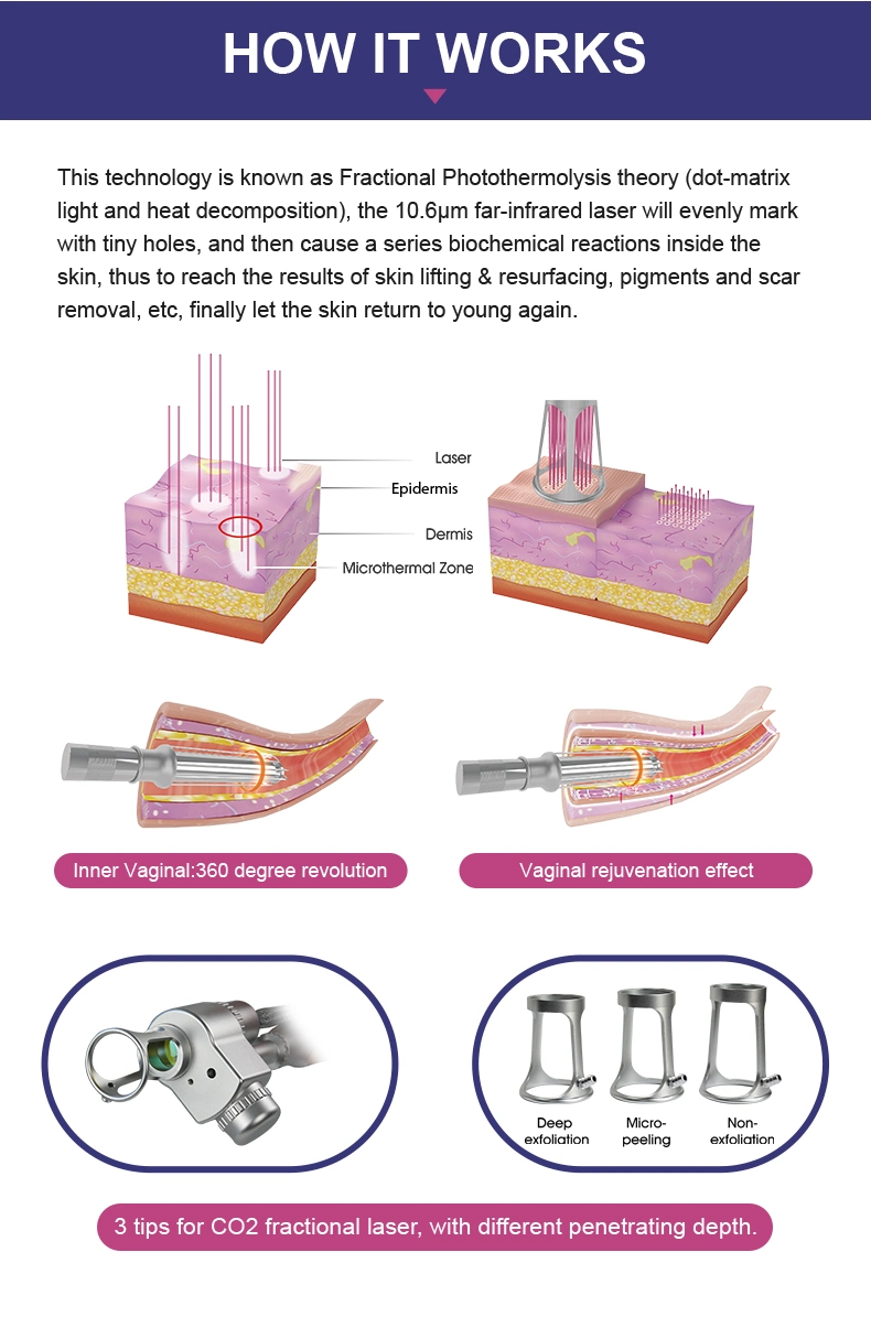 CO2 Fractional Laser Scar Removal RF Fractional Laser Beauty Machine