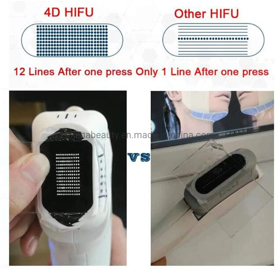 Multifunctional Liposonic 4D Hifu Beauty Machine with Vmax Hifu Vaginal Tightening and Skin Analysis