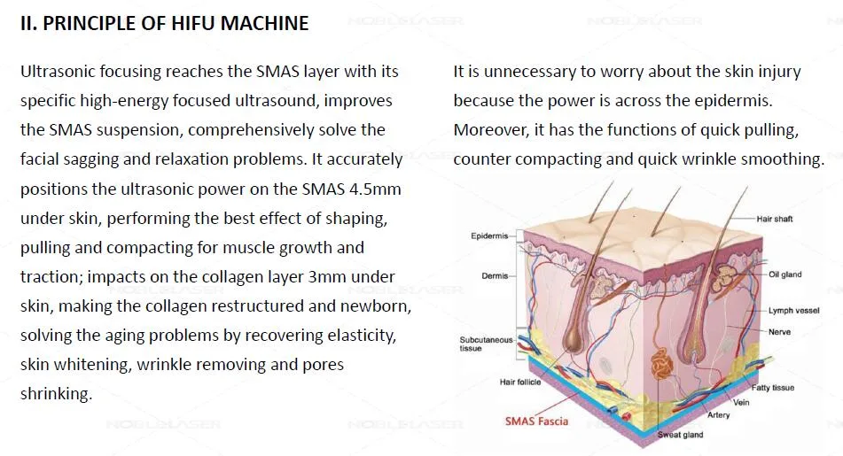 3D Hifu Beauty Equipment Anti Wrinkle Face Lift Hifu Machine - Beijing Noble Laser Hf-C