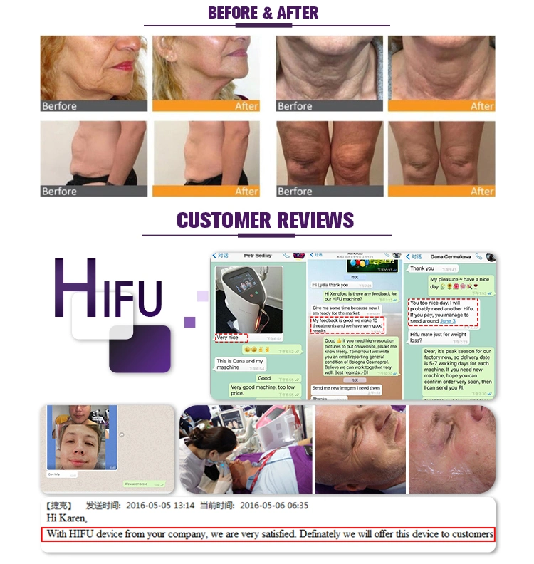 CE Approved Hifu Face Lift Machine with Hifu 8 Cartridges Hifu Face Care Body Slimming