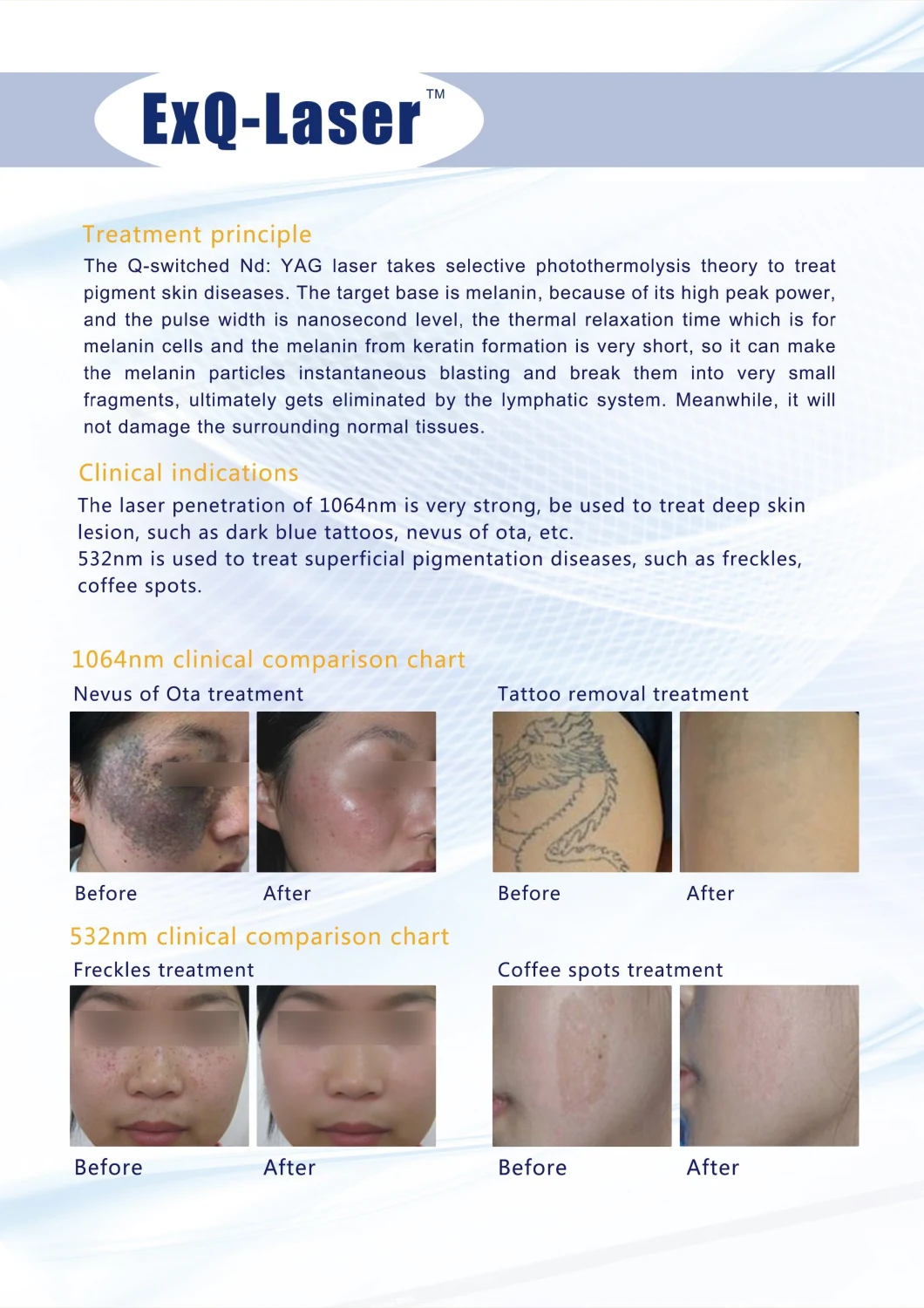 FDA TUV CE Approved Picosecond Tattoo Removal Laser Medical Quality
