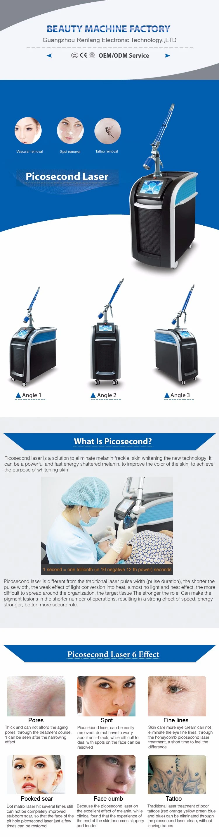 Renlang laser Tattoo Removal Picosecond Laser Removal Tattoo Pigment