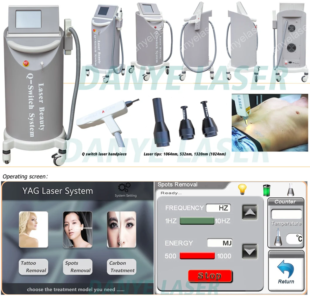 Beauty Equipment Q-Switch Laser for Tattoo Removal Acne Removal Machine 1064 Nm ND YAG Laser