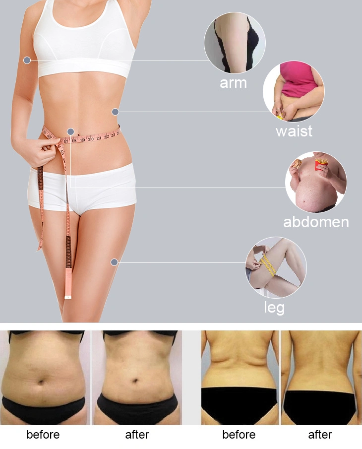 Fast Treatment Lose Weight Most Effective Body Shaping Hifu Liposonix Slimming Beauty Machine