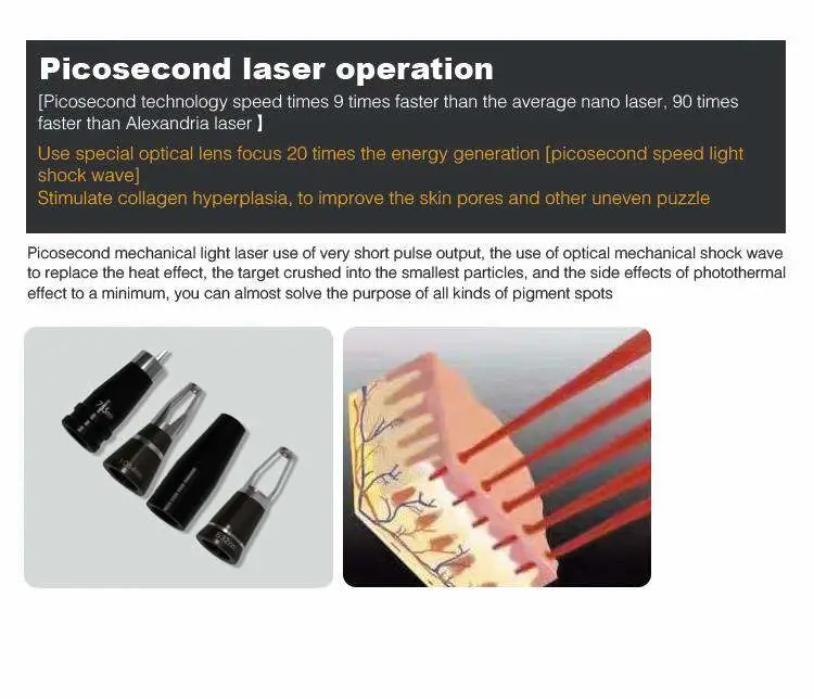Laser Q-Switch ND YAG Laser 1064nm/532nm
