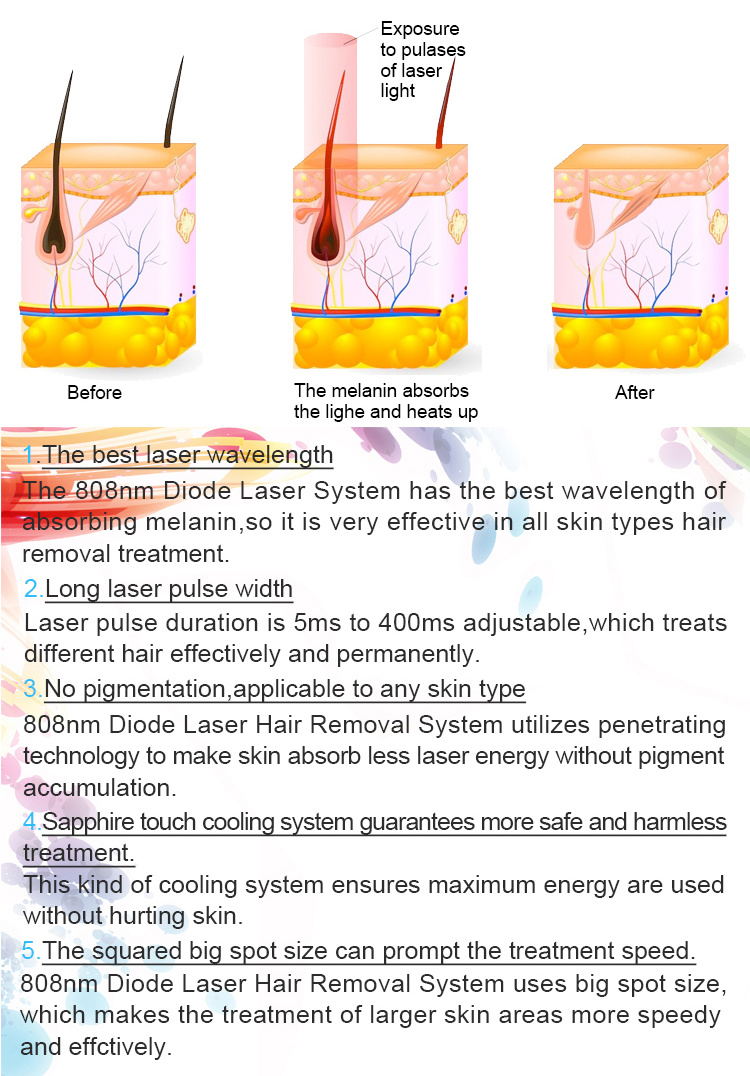 Professional Diode Laser / 3 Wavelength Diode Laser Hair Removal/ 808 Diode Laser Hair Removal Machine