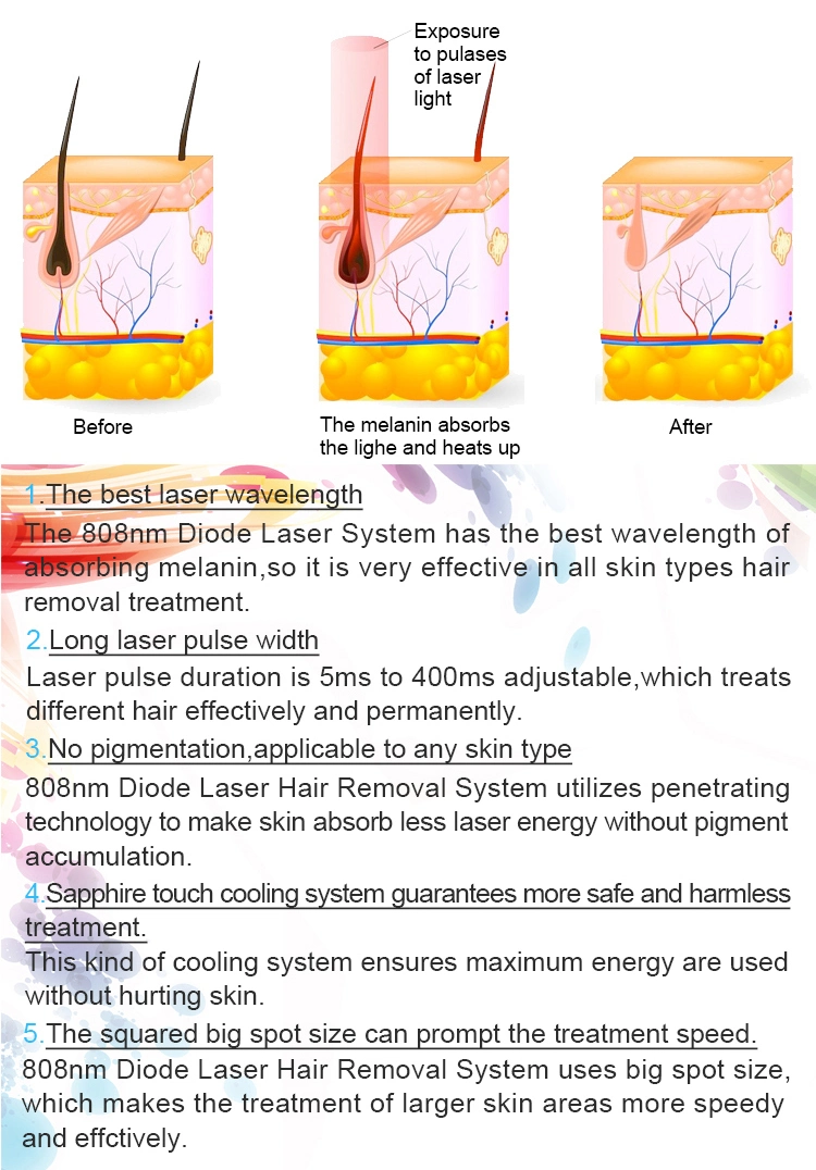 Professional FDA TUV Medical Ce Approved Laser Diode 808 Nm/Diode Laser Permanent Hair Removal Machine