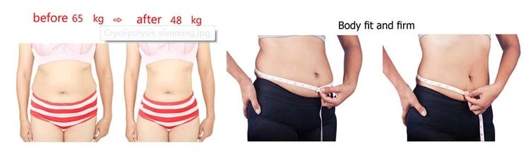 Hottest 4 Cryo Handles Work Together Cool Sculpting Fat Freezing Machine Permanent Body Slimming Coolsculpting Equipment