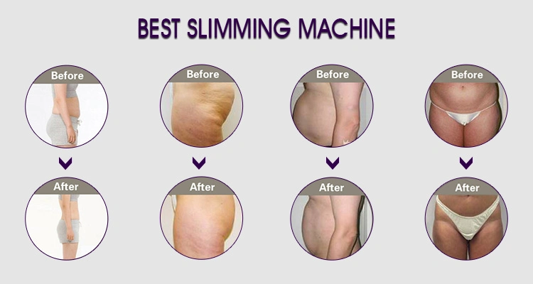 Vacuum Cryo Weight Loss Machine/Body Cryo Slimming Machine/Body Sculpting Machine