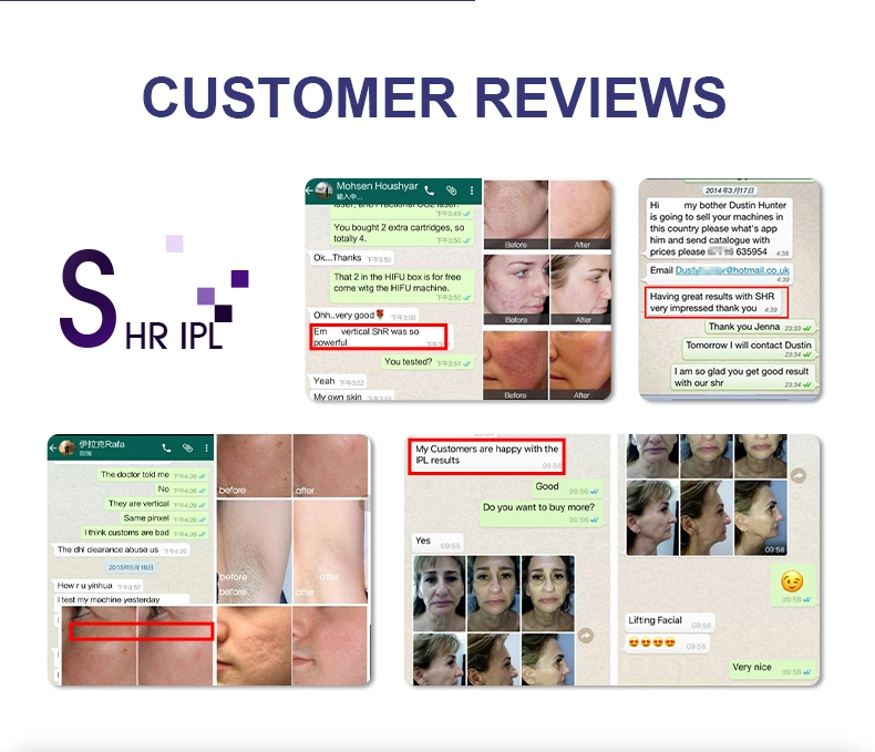 2021 IPL+Elight+RF Multifunctional IPL Hair Removal Opt Shr IPL Laser Hair Removal