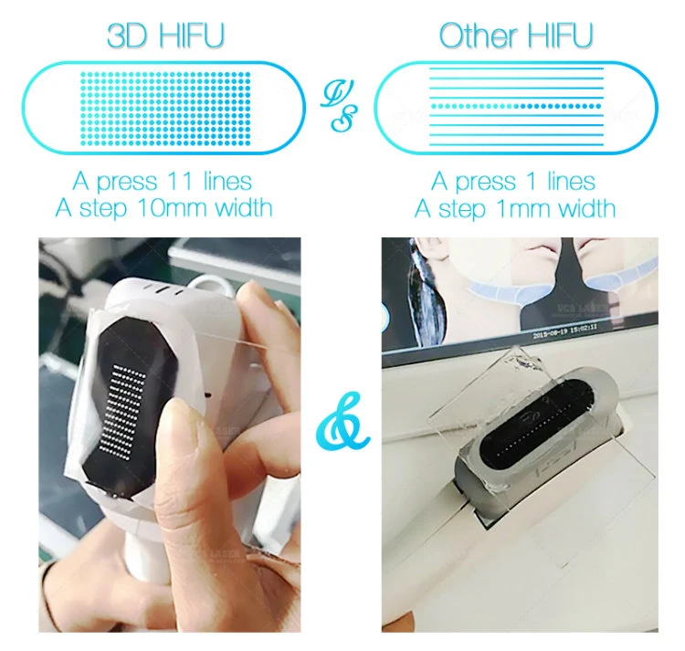 Wholesale Price Hifu3d Body Slimming Machine 3D Hifu Focused Ultrasound Hifu Machine