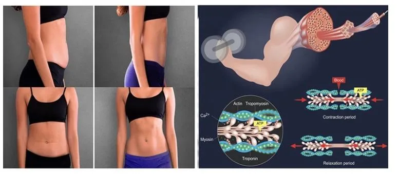 Non-Invasive Body Slimming Machine for Body Shaping and Muscle Stimulator