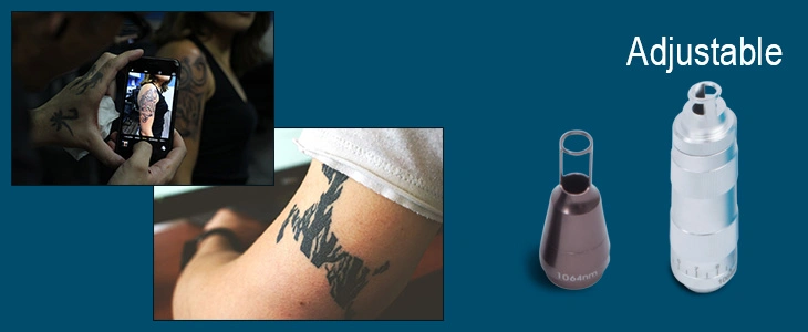 Q-Switched Laser Tattoo Removal Skin Rejuvenation Laser Tattoo Equipment