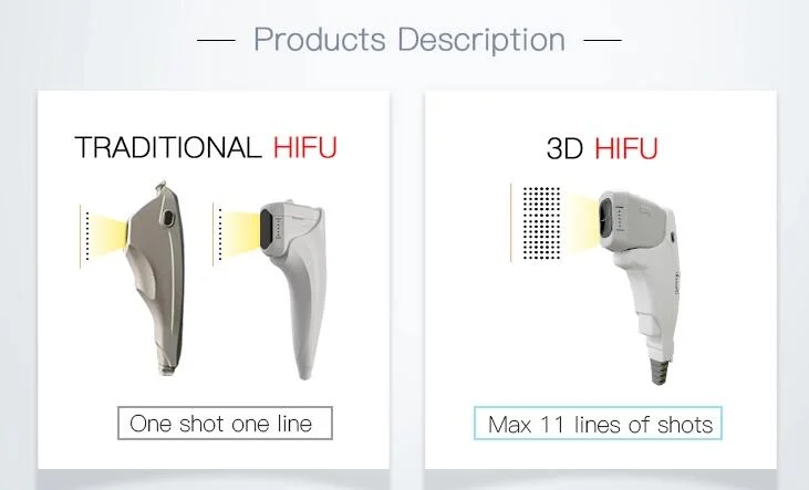 Hifu High Intensity Focused Ultrasound Hifu Face Lifting Skin Care Wrinkle Removal Hifu Beauty Machine