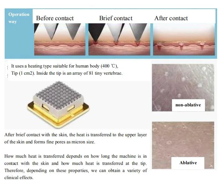 2020 New Arrival Microneedle Acne Treatment Skin Rejuvenation Wrinkle Removal Machine