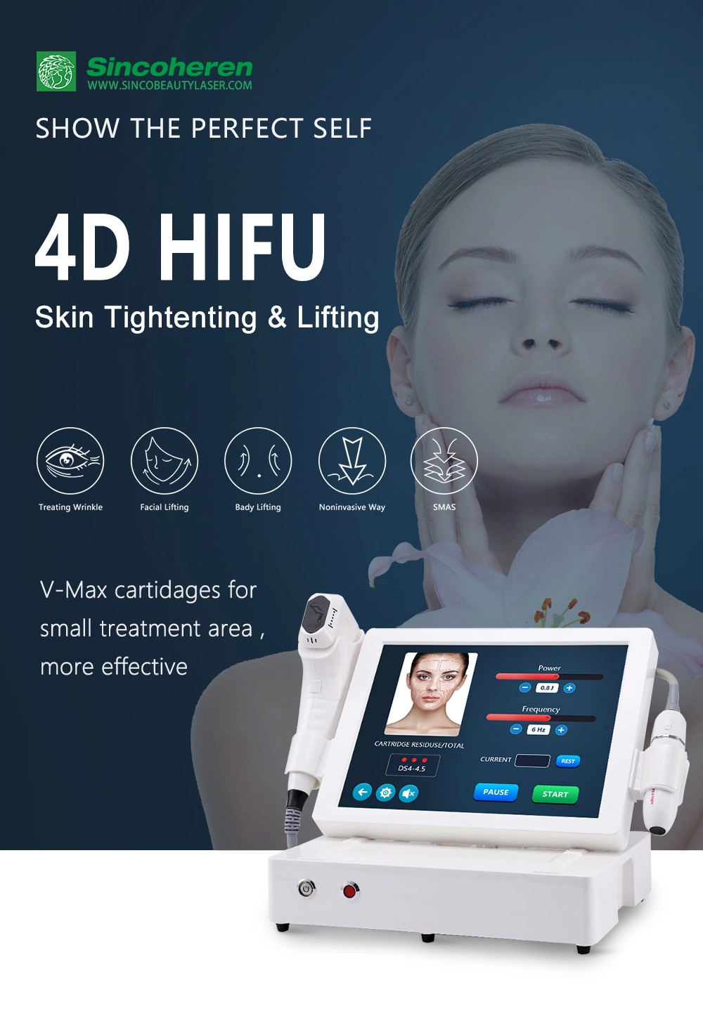 Portable Vmax Smas Face Lifting Anti Wrinkle 4D Hifu Machine