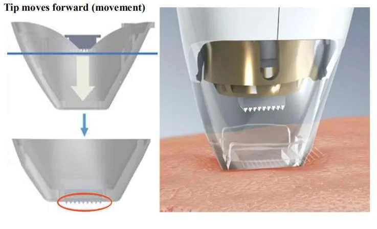 2020 New Arrival Microneedle Acne Treatment Skin Rejuvenation Wrinkle Removal Machine