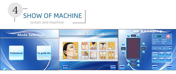 20000 Shots Face Lift Medical Wrinkle Removal 4D Hifu Machine